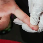 SUS passa a oferecer teste rápido de dengue