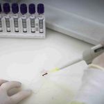 Secretaria de Saúde de SP investiga novo caso suspeito de ebola 